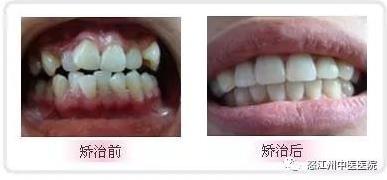 ​怒江州中医医院科室特色疗法之口腔科篇(图1)